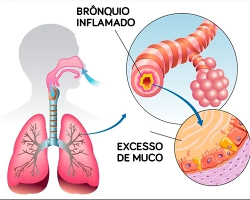 Profissional de fisioterapia respiratoria realizando atendimento na Clínica Sphera