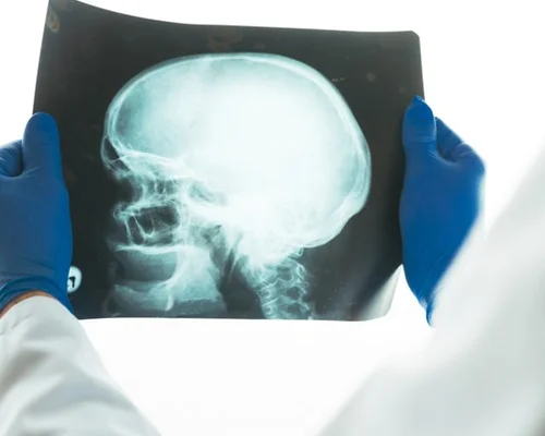 Profissional de fisioterapia neurologica realizando atendimento na Clínica Sphera